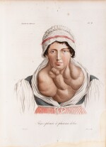 Nosologie naturelle. 1817. Maroquin rouge, armes de la duchesse de Berry. 24 belles planches médicales.